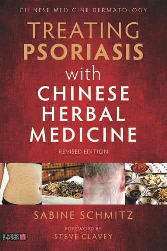 Treating Psoriasis with Chinese Herbal Medicine A Practical Handbook