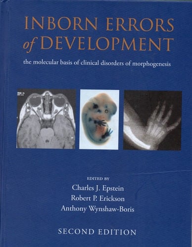 Inborn Errors of Development (Oxford Monographs on Medical Genetics)