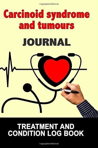 Carcinoid Syndrome and Tumours Journal Treatment and Condition Log Book, 150 College-Ruled Pages