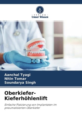 Oberkiefer-Kieferhöhlenlift: Einfache Platzierung von Implantaten im pneumatisierten Oberkiefer (German Edition)