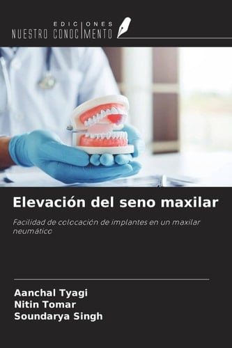 Elevación del seno maxilar: Facilidad de colocación de implantes en un maxilar neumático (Spanish Edition)