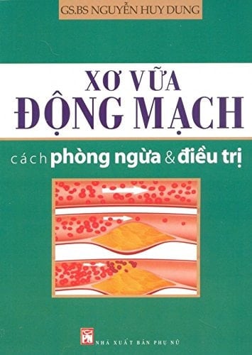 Xơ Vữa Động Mạch - Cách Phòng Ngừa & Điều Trị