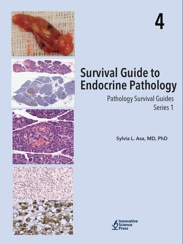 Survival Guide to Endocrine Pathology
