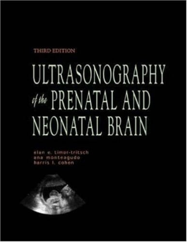 Ultrasonography of the Prenatal & Neonatal Brain