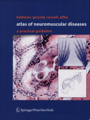 Atlas of Neuromuscular Diseases A Practical Guideline