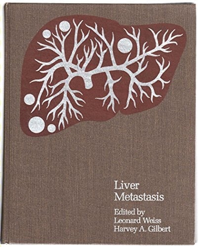 Liver Metastasis: A Monograph Series