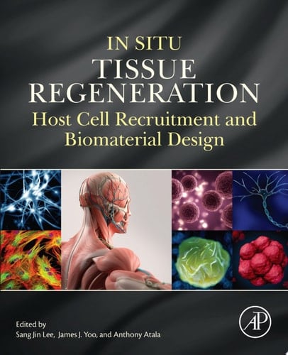 In Situ Tissue Regeneration