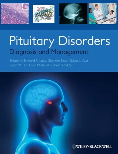 Pituitary Disorders Diagnosis and Management