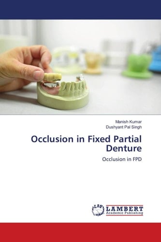 Occlusion in Fixed Partial Denture: Occlusion in FPD