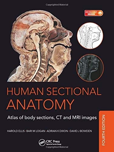 Human Sectional Anatomy Atlas of Body Sections, CT and MRI Images
