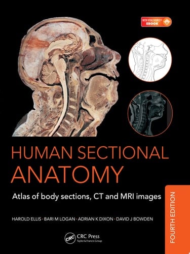 Human Sectional Anatomy