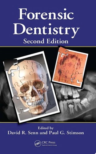 Forensic Dentistry