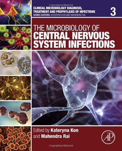 The Microbiology of Central Nervous System Infections
