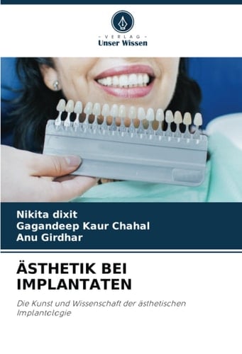 ÄSTHETIK BEI IMPLANTATEN: Die Kunst und Wissenschaft der ästhetischen Implantologie (German Edition)