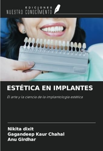 ESTÉTICA EN IMPLANTES: El arte y la ciencia de la implantología estética (Spanish Edition)