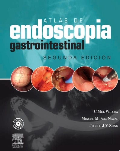 Atlas de endoscopia gastrointestinal clínica