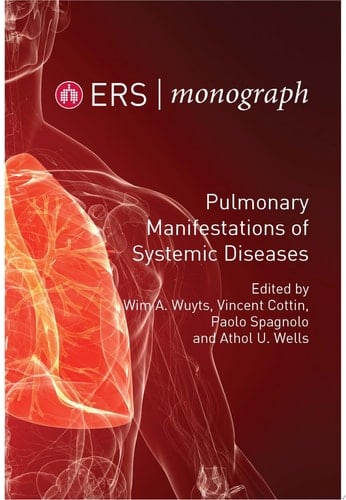Pulmonary Manifestations of Systemic Diseases