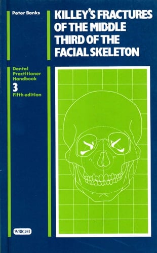 Killey's Fractures of the Middle Third of the Facial Skeleton (DENTAL PRACTITIONER HANDBOOK) (Spanish and English Edition)