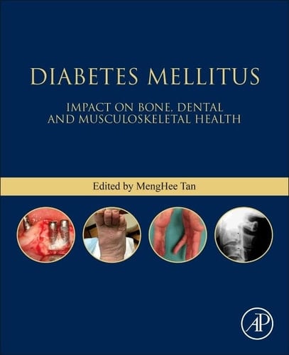 Diabetes Mellitus Impact on Bone, Dental and Musculoskeletal Health