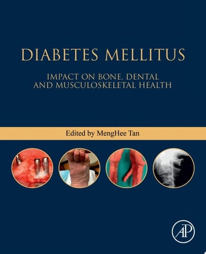 Diabetes Mellitus