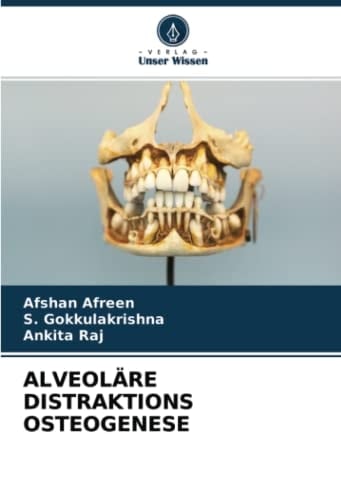 ALVEOLÄRE DISTRAKTIONS OSTEOGENESE (German Edition)