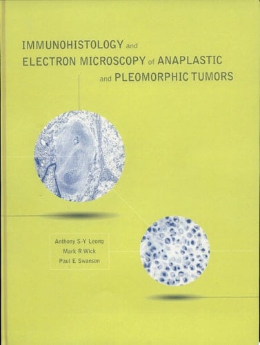 Immunohistology and Electron Microscopy of Anaplastic and Pleomorphic Tumors