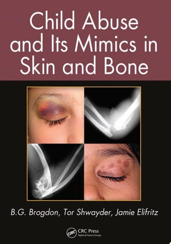Child Abuse and its Mimics in Skin and Bone