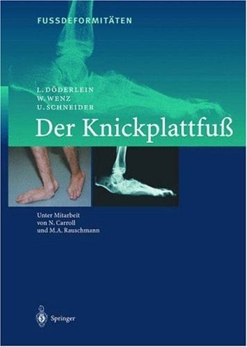 Fußdeformitäten Der Knickplattfuß. ...