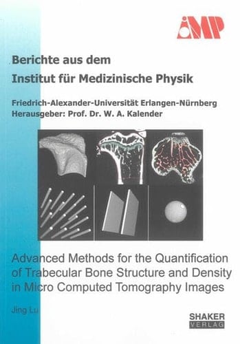 Advanced Methods for the Quantification of Trabecular Bone Structure and Density in Micro Computed Tomography Images