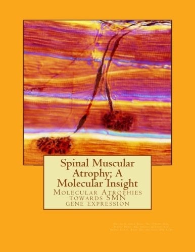 Spinal Muscular Atrophy; a Molecular Insight Molecular Atrophies and Promoter Region of SMN Genes
