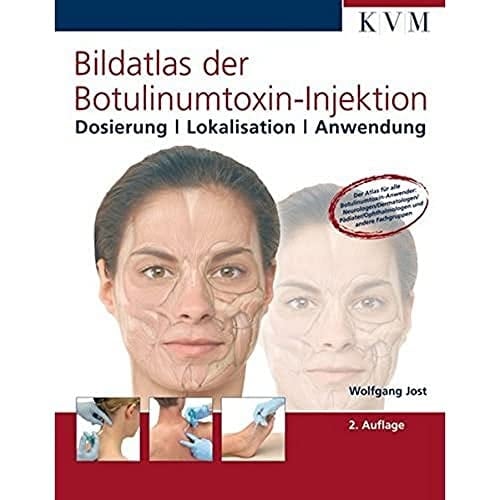 Bildatlas der Botulinumtoxin-Injektion Dosierung - Lokalisation - Anwendung