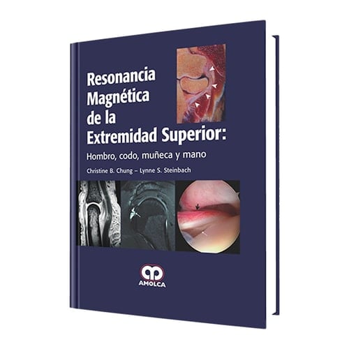 Resonancia magnetica de la extremidad superior (Spanish Edition)