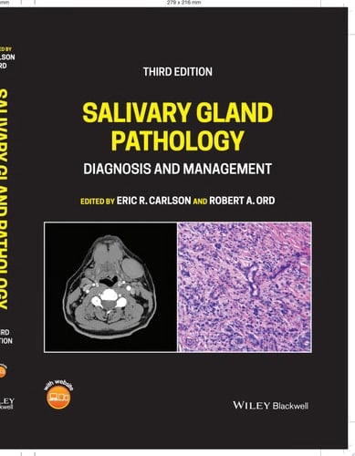 Salivary Gland Pathology Diagnosis and Management
