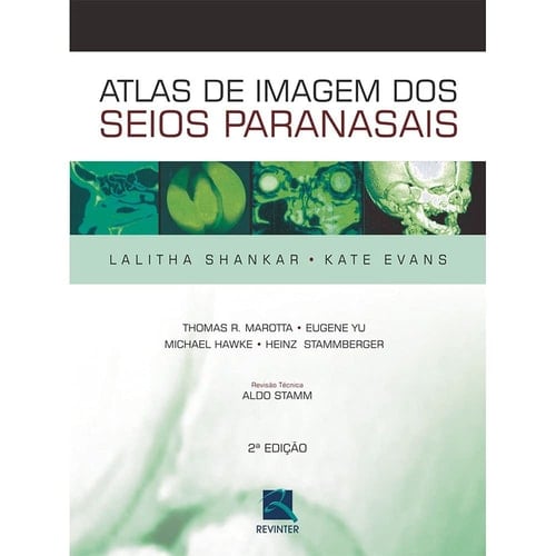 Atlas De Imagens Dos Seios Paranasais