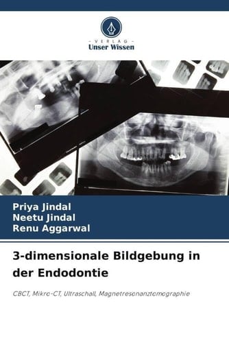 3-dimensionale Bildgebung in der Endodontie: CBCT, Mikro-CT, Ultraschall, Magnetresonanztomographie (German Edition)
