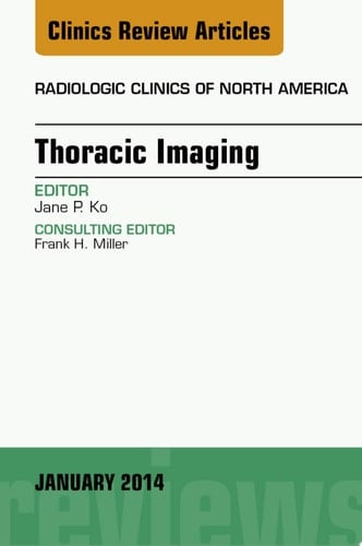 Thoracic Imaging, An Issue of Radiologic Clinics of North America
