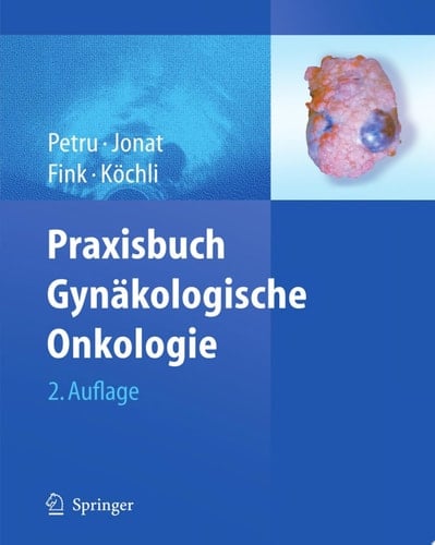 Praxisbuch Gynäkologische Onkologie