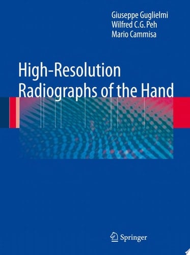 High-Resolution Radiographs of the Hand