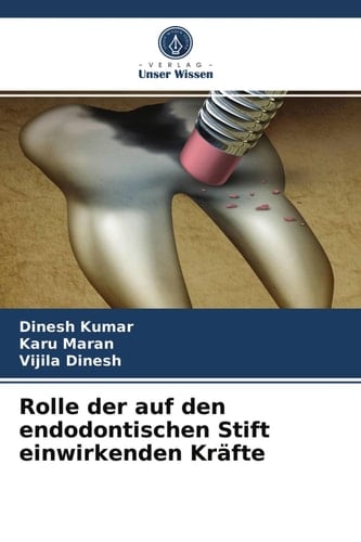 Rolle der auf den endodontischen Stift einwirkenden Kräfte (German Edition)