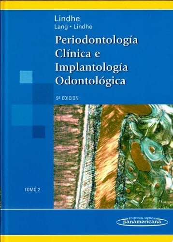 Periodontologia Clinica E Implantologia Odontologica