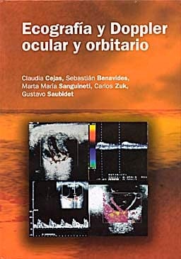 Ecografia y Doppler Ocular y Orbitario
