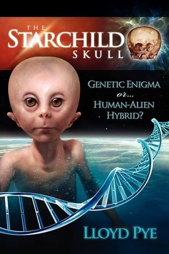 The Starchild Skull -- Genetic Enigma Or Human-Alien Hybrid?