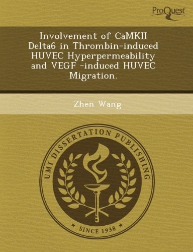 This is not available 001397