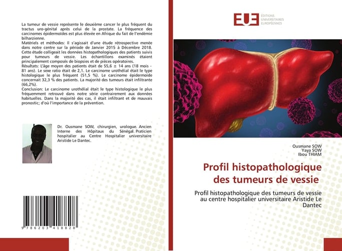 Profil histopathologique des tumeurs de vessie: Profil histopathologique des tumeurs de vessie au centre hospitalier universitaire Aristide Le Dantec (French Edition)
