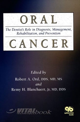 Oral Cancer: The Dentist's Role in Diagnosis, Management, Rehabilitation, and Prevention