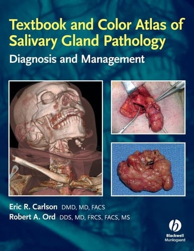 Textbook and Color Atlas of Salivary Gland Pathology Diagnosis and Management