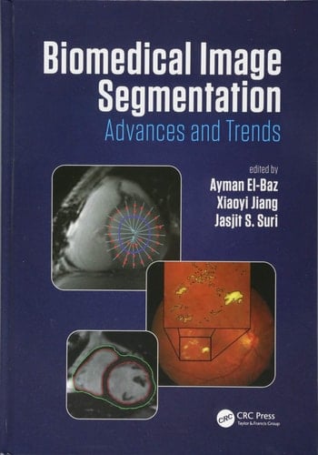 Biomedical Image Segmentation Advances and Trends