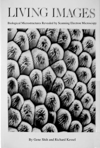 Living images: Biological microstructures revealed by scanning electron microscopy