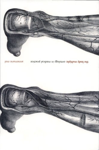 The Body Multiple Ontology in Medical Practice