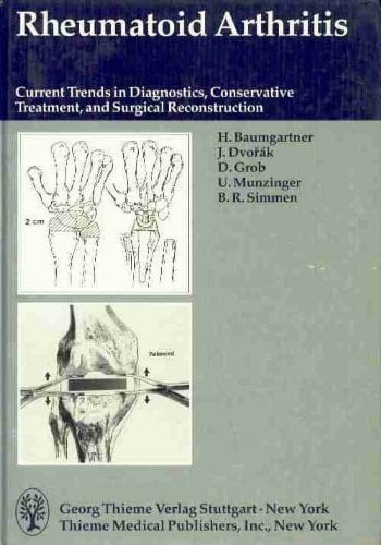 Rheumatoid Arthritis Current Trends in Diagnostics, Conservative Treatment, and Surgical Reconstruction